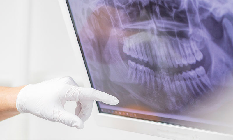 Röntgenbild | Praxis Dr. med. dent. Goller -Schallstadt